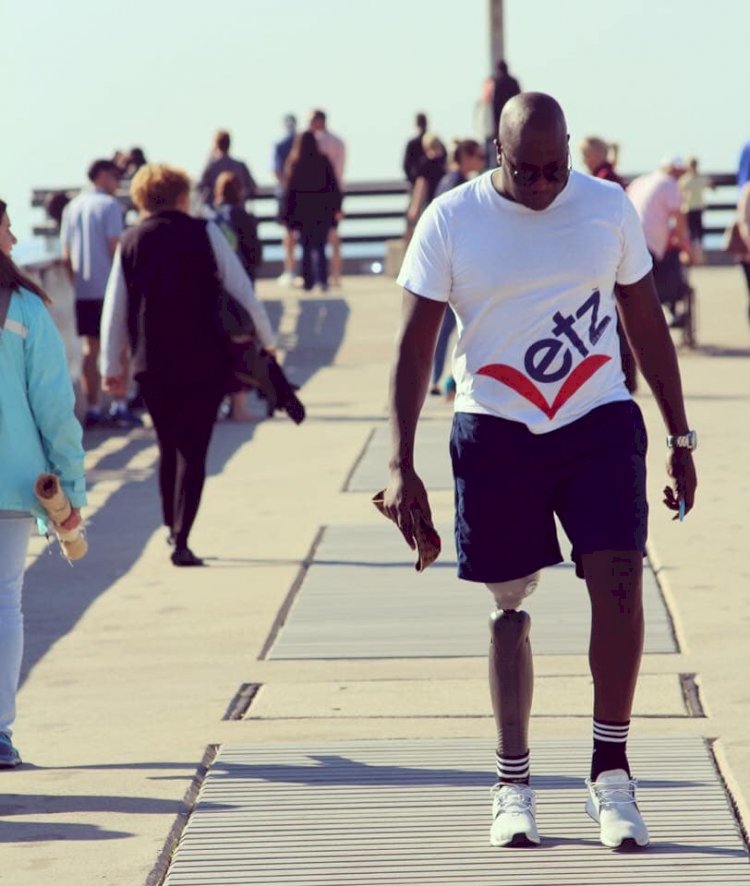 I lost my leg but found my purpose! South African shares inspiring story!