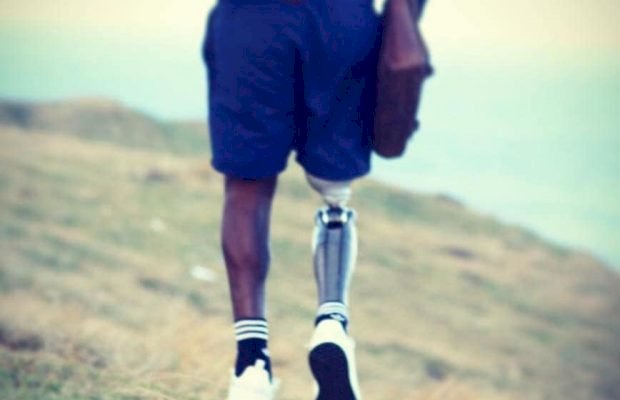 I lost my leg but found my purpose! South African shares inspiring story!