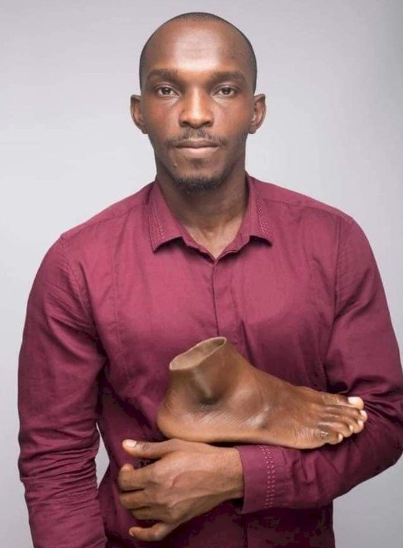Meet John Amanam The Prostheses Genius Giving Hope To Amputees In Africa And Beyond
