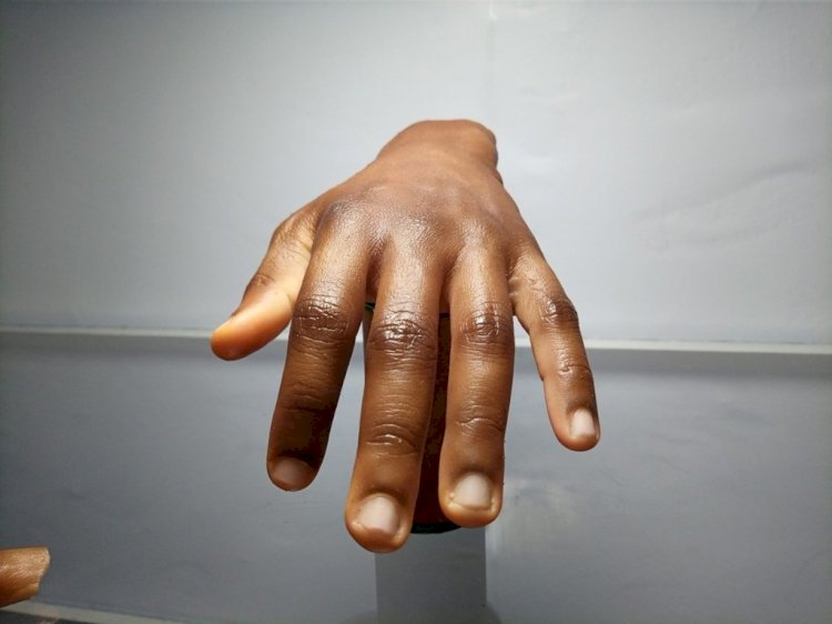 Meet John Amanam The Prostheses Genius Giving Hope To Amputees In Africa And Beyond